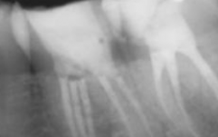 Endodontics Endodontics